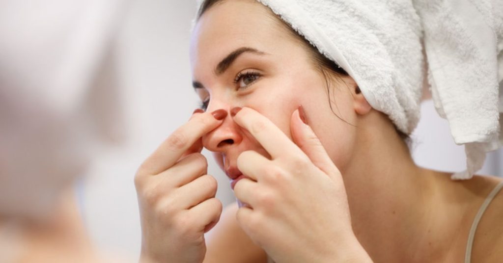 girl fixing her pimples and acne skin issue
