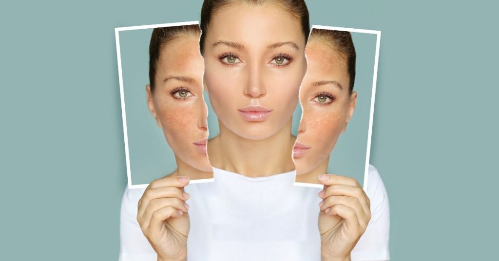 girls face in pic after whitening myth